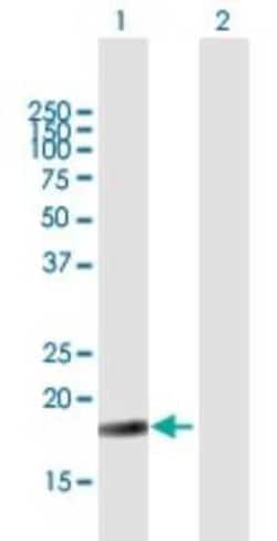Novus Biologicals NIP7 Antibody, Novus Biologicals 0.05 mg | Buy Online | Novus Biologicals&trade; | Fisher Scientific
