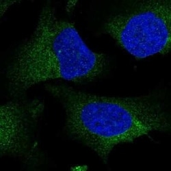 NIT2 Antibody, Novus Biologicals 0.1 mL; Unconjugated:Antibodies, Polyclonal