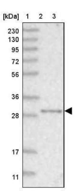 NIT2 Antibody, Novus Biologicals 0.1 mL; Unconjugated:Antibodies, Polyclonal