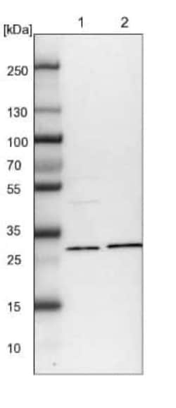 NIT2 Antibody, Novus Biologicals 0.1 mL; Unconjugated:Antibodies, Polyclonal
