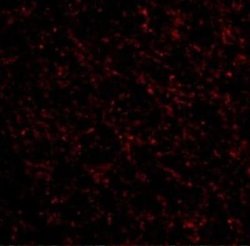 NK3R/TACR3/Neurokinin B Receptor Antibody - BSA Free, Novus Biologicals