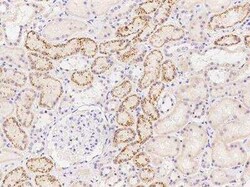 NK3R/TACR3/Neurokinin B Receptor Antibody, Novus Biologicals:Antibodies:Primary