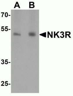 NK3R/TACR3/Neurokinin B Receptor Antibody - BSA Free, Novus Biologicals