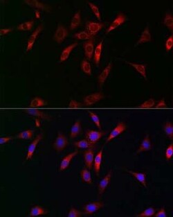 NKIRAS1 Antibody - Azide and BSA Free, Novus Biologicals 0.02 mL; Unconjugated:Antibodies,