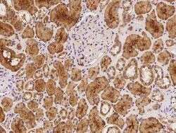 NKIRAS1 Antibody, Novus Biologicals 100 &mu;g; Unconjugated:Antibodies,