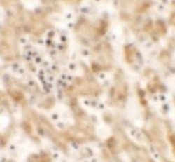NKX2.8 Antibody - BSA Free, Novus Biologicals 0.1 mg; Unconjugated:Antibodies,