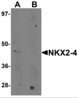 NKX2-4 Antibody - BSA Free, Novus Biologicals 0.1 mg | Buy Online | Novus Biologicals | Fisher Scientific