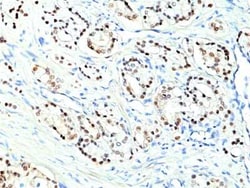 NKX3.1 Rabbit anti-Human, Clone: RM430, Novus Biologicals:Antibodies:Primary