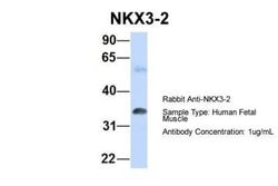 NKX3-2 Antibody, Novus Biologicals 100 &mu;L; Unconjugated:Antibodies,