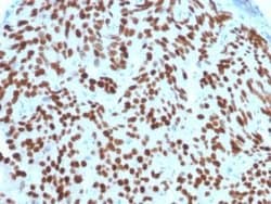NKX3.1 Antibody (NKX3.1/2576) - Azide and BSA Free, Novus Biologicals 100