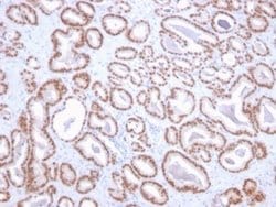 NKX3.1 Antibody (NKX3.1/2836) - Azide and BSA Free, Novus Biologicals 100