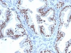 NKX3.1 Antibody (rNKX3.1/6620) - Azide and BSA Free, Novus Biologicals 100 &mu;g | Buy Online | Novus Biologicals | Fisher Scientific