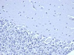 NKX3.1 Mouse anti-Human, Clone: rNKX3.1/6620, Novus Biologicals:Antibodies:Primary