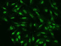 NKX6.1 Antibody, Novus Biologicals 100 &mu;g, Unconjugated:Antibodies,