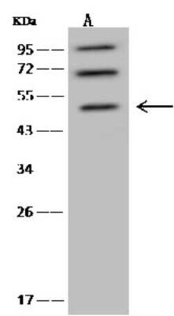 NLE1 Antibody, Novus Biologicals 100 &mu;g, Unconjugated:Antibodies, Polyclonal