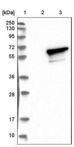 NLK Antibody, R D Systems 25 &mu;L | Buy Online | R&D Systems | Fisher Scientific