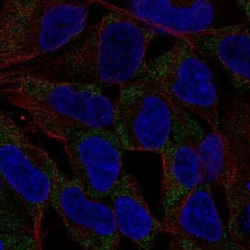 NLRP11 Antibody, Novus Biologicals 25ul; Unconjugated:Antibodies, Polyclonal