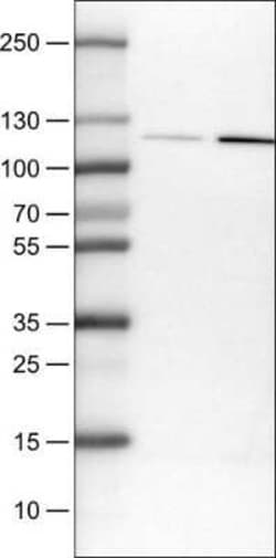 NLRP3/NALP3 Antibody (CL0210), Novus Biologicals 25 &mu;L, Unconjugated:Antibodies,