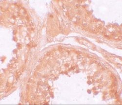 NLRP9 Antibody - BSA Free, Novus Biologicals 0.1 mg | Buy Online | Novus Biologicals | Fisher Scientific