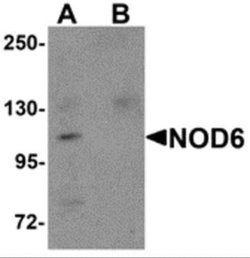 NLRP9 Antibody - BSA Free, Novus Biologicals 0.1 mg | Buy Online | Novus Biologicals | Fisher Scientific