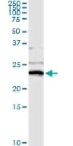 NM23-H1 Antibody (1D7), Novus Biologicals 0.1 mg | Buy Online | Novus Biologicals | Fisher Scientific