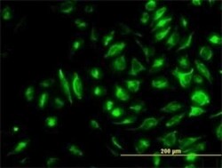 NM23-H2/NME2 Antibody (1D3), Novus Biologicals 0.1 mg | Buy Online | Novus Biologicals | Fisher Scientific