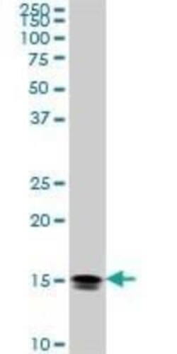 NM23-H2/NME2 Antibody (1E4), Novus Biologicals 0.1 mg | Buy Online | Novus Biologicals | Fisher Scientific