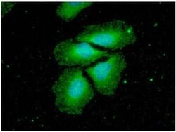 NM23-H2/NME2 Mouse anti-Human, Clone: 2000, Novus Biologicals:Antibodies:Primary