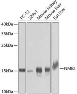 NM23-H2/NME2 Antibody - BSA Free, Novus Biologicals:Antibodies:Primary