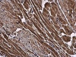 NMD3 Antibody, Novus Biologicals 100 &mu;g; Unconjugated:Antibodies, Polyclonal
