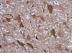 NMDAR1 Antibody, Novus Biologicals 100 &mu;g | Buy Online | Bio-Techne | Fisher Scientific