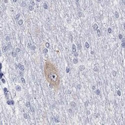 NMDAR1 Rabbit anti-Human, Polyclonal, Novus Biologicals:Antibodies:Primary