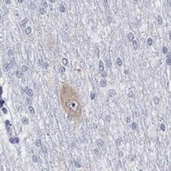 NMDAR1 Rabbit anti-Human, Polyclonal, Novus Biologicals:Antibodies:Primary