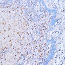 NME6 Antibody - Azide and BSA Free, Novus Biologicals:Antibodies:Primary