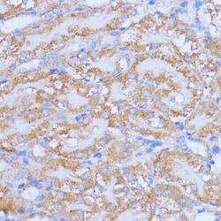 NME6 Antibody - Azide and BSA Free, Novus Biologicals:Antibodies:Primary