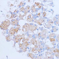 NME6 Antibody - Azide and BSA Free, Novus Biologicals:Antibodies:Primary