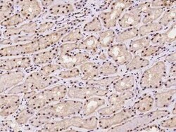 NMNAT-1 Antibody, Novus Biologicals 100 &mu;g | Buy Online | Novus Biologicals | Fisher Scientific