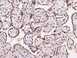 NMNAT-1 Antibody, Novus Biologicals 100 &mu;g | Buy Online | Novus Biologicals | Fisher Scientific
