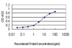 NMNAT-2 Antibody (2E4), Novus Biologicals 0.1 mg | Buy Online | Novus Biologicals | Fisher Scientific