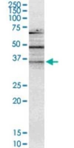 NMNAT-2 Antibody (4E6), Novus Biologicals 0.1 mg | Buy Online | Novus Biologicals | Fisher Scientific