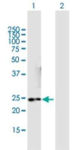 NMNAT3 Antibody, Novus Biologicals 0.05 mg | Buy Online | Novus Biologicals | Fisher Scientific