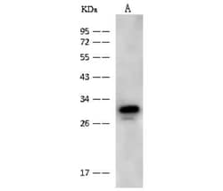 NMRAL1 Antibody, Novus Biologicals™