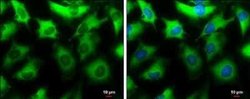 NMT1 Antibody, Novus Biologicals 100 &mu;g; Unconjugated:Antibodies, Polyclonal