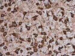 NMT1 Antibody, Novus Biologicals 100 &mu;g; Unconjugated:Antibodies, Polyclonal