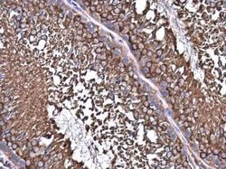 NMT1 Antibody, Novus Biologicals 100 &mu;g; Unconjugated:Antibodies, Polyclonal