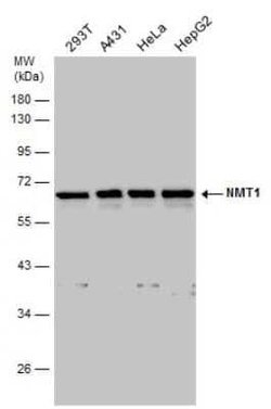 NMT1 Antibody, Novus Biologicals 100 &mu;g; Unconjugated:Antibodies, Polyclonal