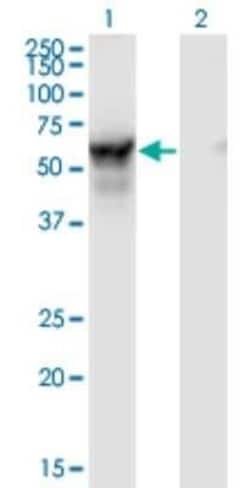 NMT2 Antibody (2E12-4B5), Novus Biologicals 0.1 mg | Buy Online | Novus Biologicals | Fisher Scientific
