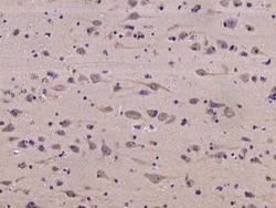 NMT2 Antibody, Novus Biologicals:Antibodies:Primary Antibodies