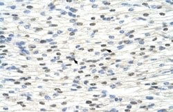 NOBOX Rabbit anti-Human, Polyclonal, Novus Biologicals 0.1ml; Unconjugated:Antibodies,