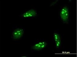 NOL7 Antibody, Novus Biologicals 0.05 mg, Unconjugated:Antibodies, Polyclonal
